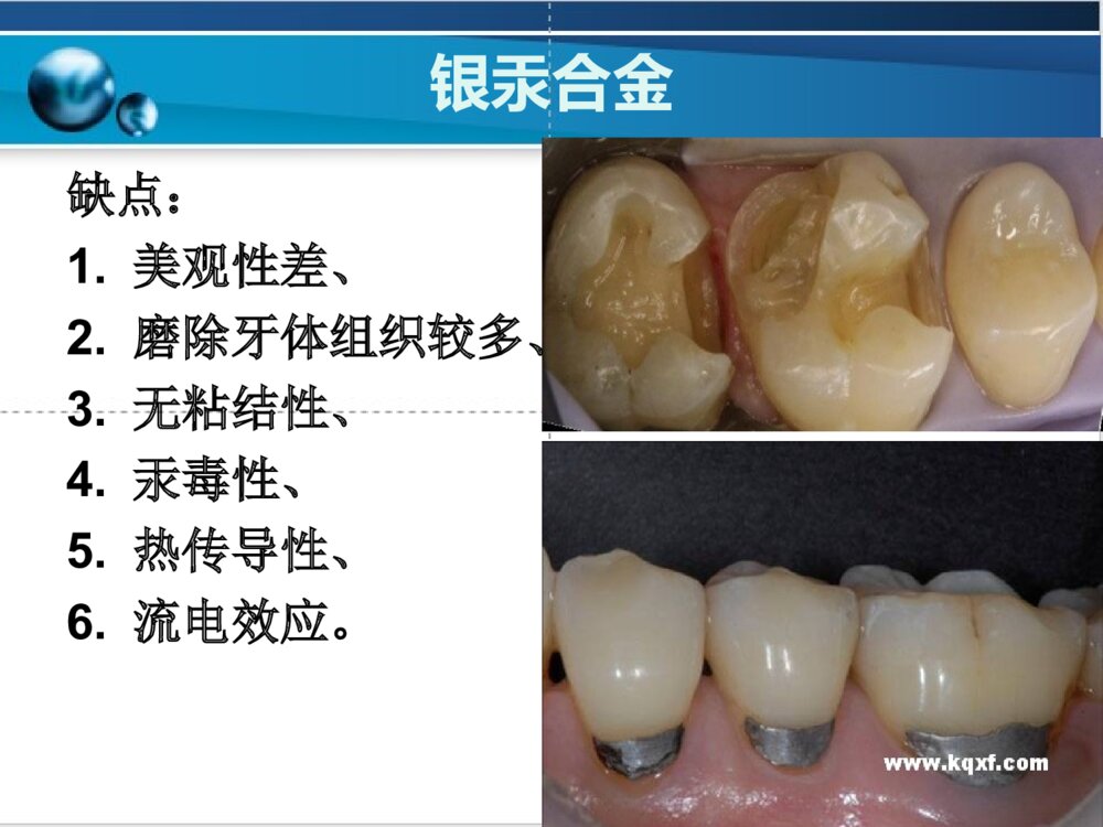 牙体缺损充填PPT课件7